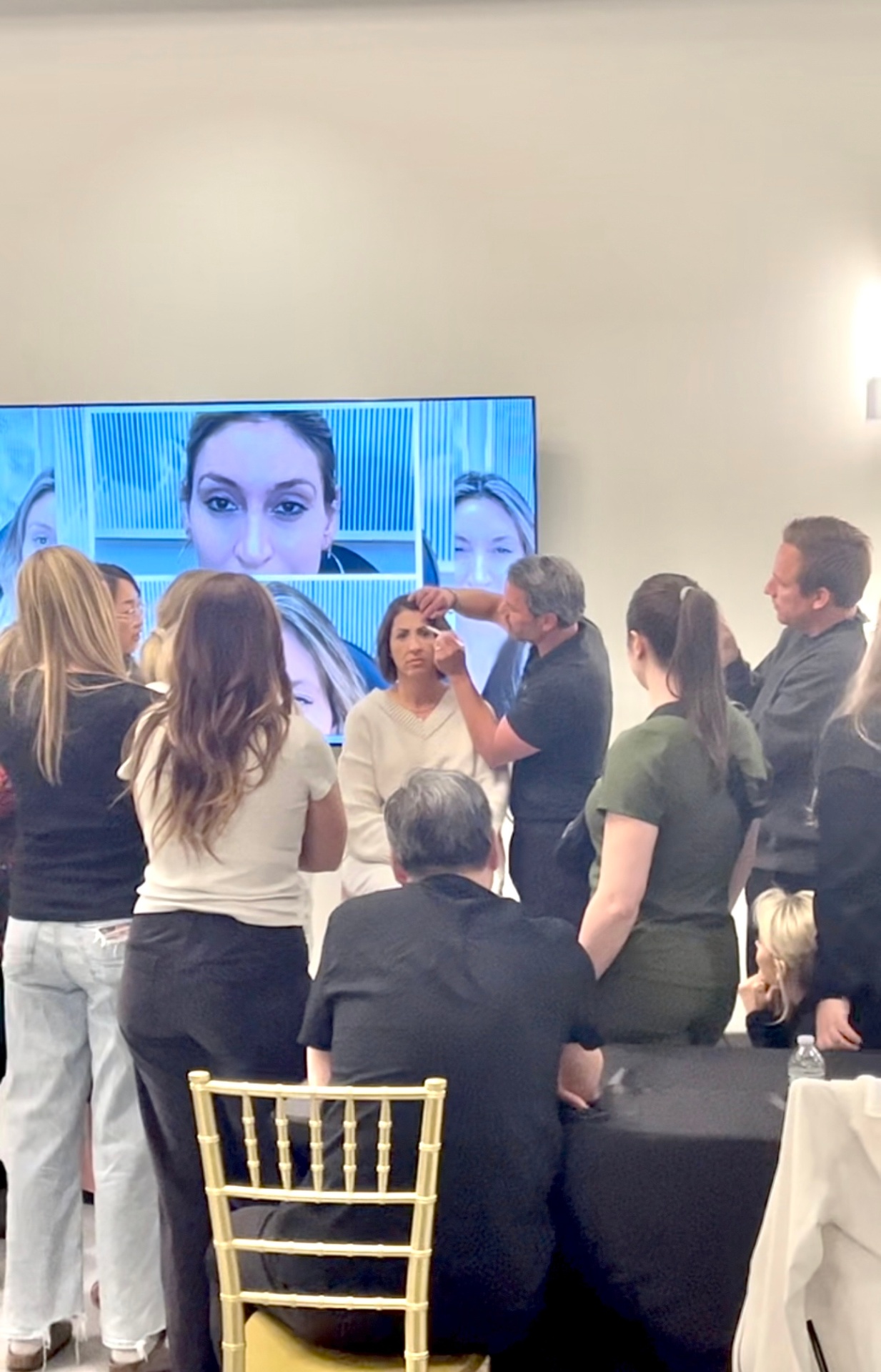 After full face rejuvenation with Botox and filler