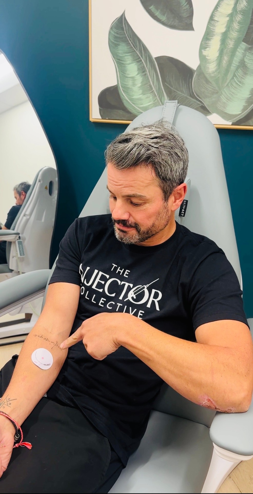 Before lip filler treatment at The Injector Collective Utah